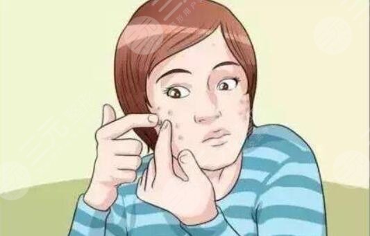 痤瘡疤痕怎么治才能徹底?