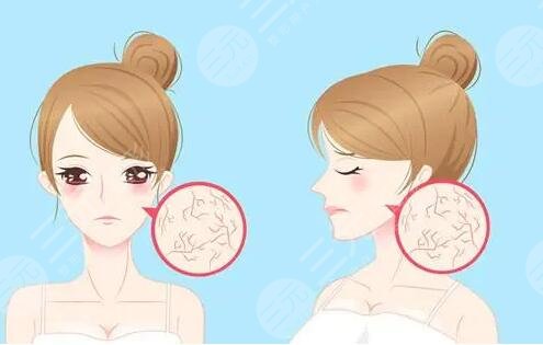 什么可以去紅血絲的方法簡(jiǎn)單又有?