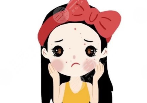 去痘價格大概多少?