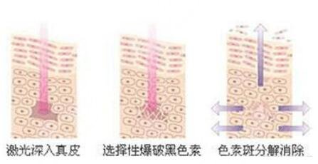 黑臉娃娃的作用原理