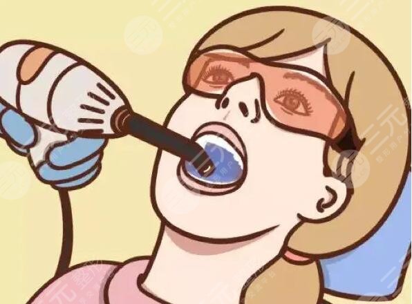 beyond冷光牙齒美白果好嗎？做一次的價格貴不貴？注意事項要乖乖照做~