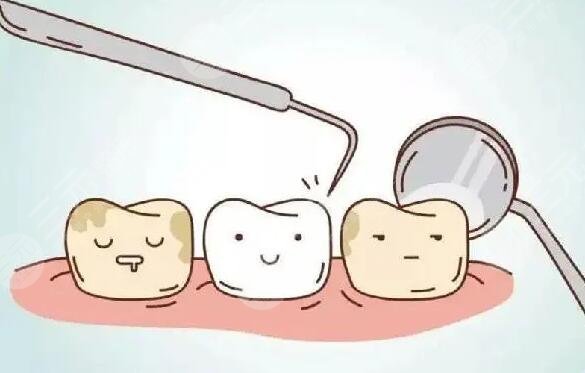 beyond冷光牙齒美白價格