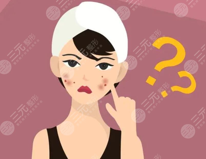 痤瘡怎么治才能徹底?