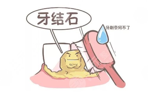 超聲波潔牙可靠嗎？