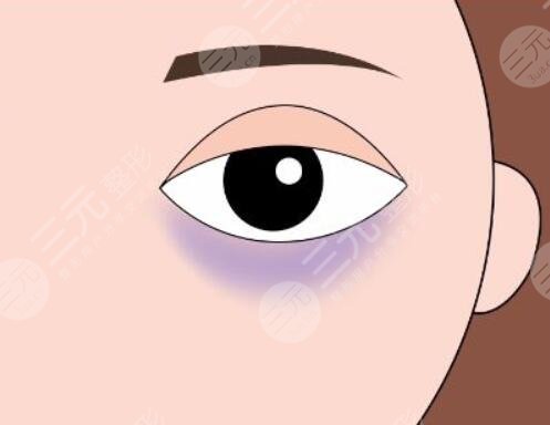 　　吃什么緩解黑眼圈果好又快速?黑眼圈可以說是我們的災難，稍微不注意黑眼圈就悄悄的冒了出來，即便擁有一張白皙靚麗的臉龐也忍受不了黑眼圈的出現，黑黑的黑眼圈一旦出現在臉上，就會讓我們看起來沒有精神，整個人焉了吧唧的。為了解決免不黑眼圈的問題，大家各種各樣的方法都是使用，目前使用的比較多的是使用各種各樣的眼霜，或者是通過醫(yī)美整形的方式來改良，又或者是通過飲食的改變來改良黑眼圈的問題，那么吃什么緩解黑眼圈?現在就和小編一起來認真的做一下功課吧!  　　一、黑眼圈是怎么出現的?  　　黑眼圈出現的原因有很多種，比較常見的一種是長時間的熬夜，導致眼部疲勞血液流通不暢，出現了紫紅色或者是青色的黑眼圈。還有一種是色素性黑眼圈，出現這種情況的原因有很多中，不單單是因為熬夜導致的，還有一些外界因素的印象，主要指因為長時間在陽光下暴曬，過多的藥物攝入，做了一些眼部手術等等，以及買了一些不適合自己的化妝品，引發(fā)了眼周蕁麻疹反映，都會導致眼周出現色素沉淀，對于這種色素性黑眼圈，主要是叫撒后這些黑色的細胞，減少黑色色素。  　　二、吃什么緩解黑眼圈果好又快速?  　　既然有黑眼圈的出現，就要積極的找到一個有的緩解方式，目前就有很多人說可以通過食物來改良黑眼圈的問題。那么具體吃哪些東西比較有果了?  　　1、攝入高蛋白的食物，高蛋白的食物有很多種，主要是牛奶，雞蛋以及各種肉類，積極增加自己的蛋白質攝入，可以有的緩解黑眼圈的形成，但是對高蛋白食物過敏的小伙伴，不建議使用這一種方法，大家可以通過其他的方式來改良自己黑眼圈的問題。  　　2、可以嘗試多吃一些動物的肝臟等食物，這些食物內部含有為豐富的維生素a，這個維生素可以很好的為我們眼周和眼球提供必需的物質，促進眼周的血液循環(huán)，幫助緩解黑眼圈。同時吃各種各樣有營養(yǎng)的食物來改良黑圈，也是一個比較好的選擇，大家可以根據自身的條件來制定一個比較不錯的食譜。  　　三、醫(yī)美整形手術改良黑眼圈  　　除了通過吃東西來改良黑眼圈以外，還有一種可實施比較有的方法，那就是通過醫(yī)美整形的方式來改良黑眼圈。目前針對黑眼圈的醫(yī)美整形項目也有幾個，小編整理了一些作用果不錯的幾個項目，現在就分享給大家吧!  　　1、激光緩解黑眼圈  　　激光緩解黑眼圈是一個比較常見的醫(yī)美整形項目，也是當下行之有的一種技術手段，他的操作難度不高，主要是通過激光的遠紅外長脈沖激光，作用在眼周的皮膚上，慢慢的滲透到皮膚深層，讓激光產生的爆破光熱能量將這些黑色素打散，改良皮膚的生成代謝，促進膠原代表的生成，在有去除黑眼圈的同時，也能樣眼周的皮膚更將光澤有彈性。這種激光緩解黑眼圈的方式一般適用于是色素性黑眼圈。  　　2、注射緩解黑眼圈  　　如果是結構性的黑眼圈，一般采用玻尿酸或者是脂肪來進行局部的注射填充來改良，這種黑眼圈一般是出現在家族遺傳病史上，隨著年紀的增加，到了十五六歲的時候就會出現結構性的黑眼圈，這時候就可以采取局部注射緩解大，可以很好的減少這種情況的出現，既而改良黑眼圈的情況。想要通過醫(yī)美整形手段改良自己的黑眼圈情況的小伙伴，一定要去正規(guī)的整形機構做手術，并且了解到自己出現黑眼圈的原因，才能制定一個可行的手術方案。