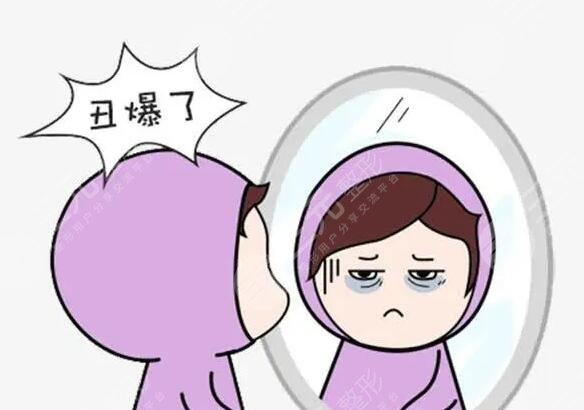 醫(yī)美整形手術改良黑眼圈