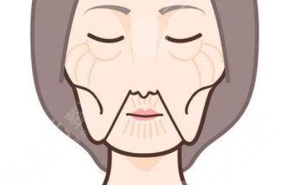 嘴角皺紋