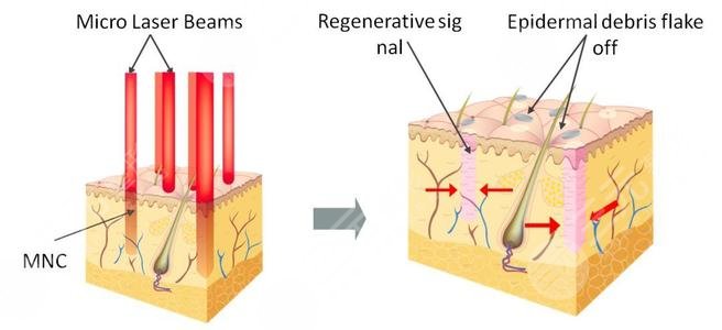 哪些醫(yī)美方式可以使皮膚變白呢?