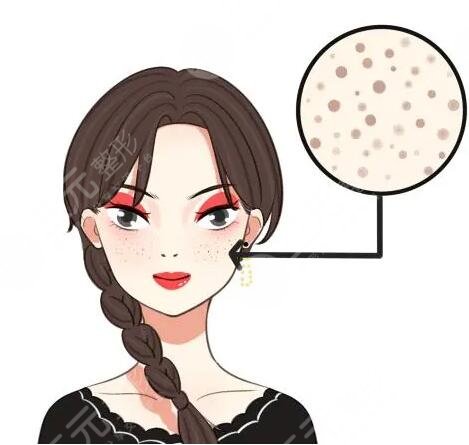 簡(jiǎn)單美白的祛斑方法