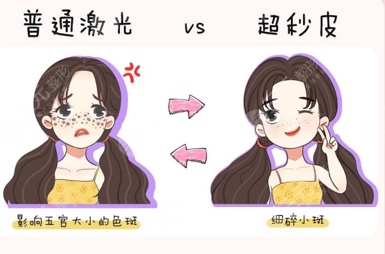 醫(yī)美祛斑方法