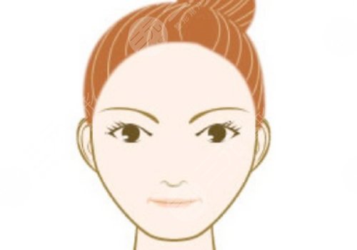 額頭窄豐額頭要多少錢?