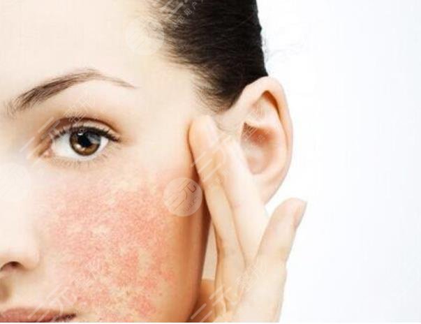 黑臉娃娃簡要介紹