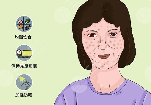 簡單美白祛斑的方法有哪些？