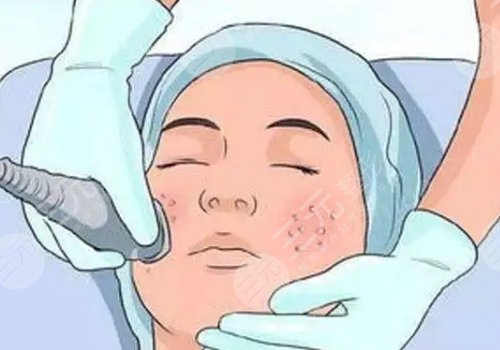 簡單美白祛斑的方法有哪些？