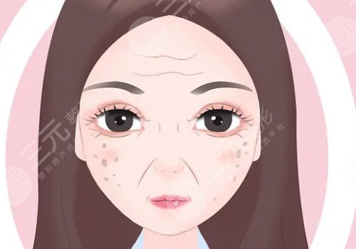 怎樣治老年斑？