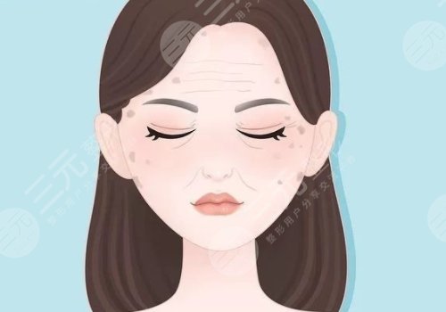 怎樣治老年斑？