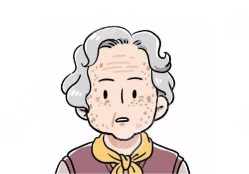 怎樣治老年斑？