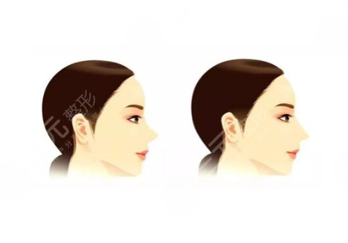 承德玥萊美醫(yī)療美容醫(yī)院怎么樣？