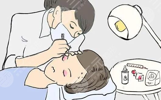 iu整容整哪里了？