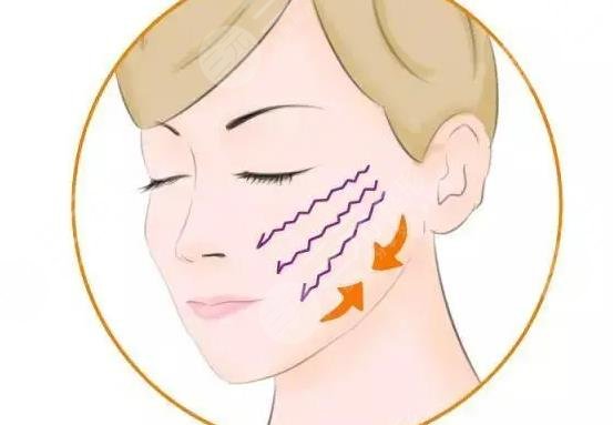 iu整容整哪里了？