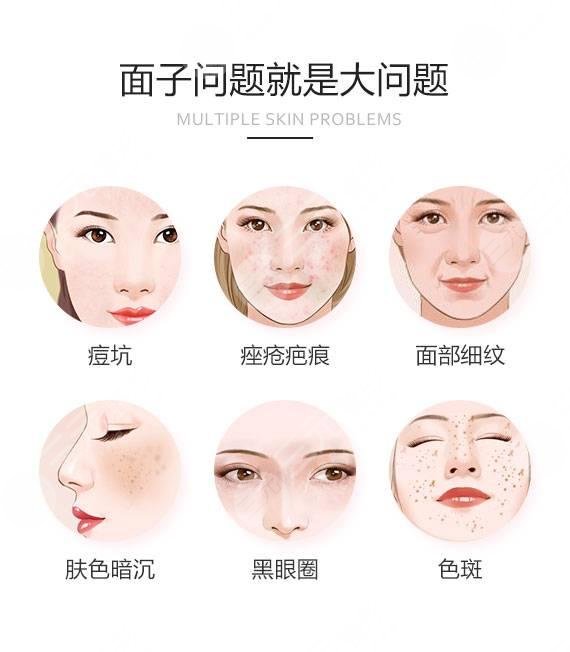 像素激光祛痘坑?果怎么樣?