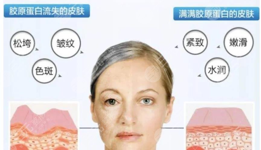 臉上的皮膚松弛怎么辦