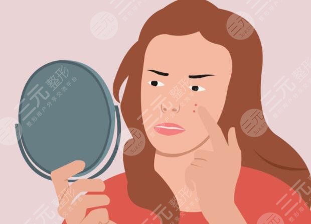 北京緩解痤瘡多少錢一個療程？針對臉上的坑坑洼洼,適合成年人長痘的方法！