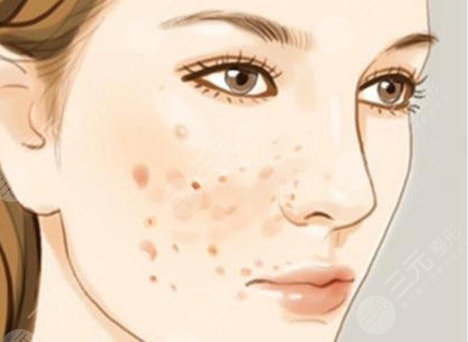 自制祛斑小妙招有哪些？正確的祛斑方式方法，不走彎路！在家就能輕松操作！