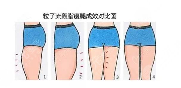 瘦腿襪真能瘦腿嗎?