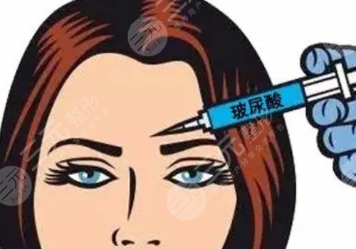 瑞蘭2號(hào)玻尿酸適合打哪里?