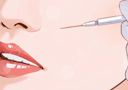 瑞蘭2號(hào)玻尿酸適合打哪里?