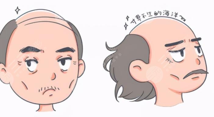 生姜能緩解脫發(fā)嗎？怎么正確使用不傷頭皮？詳細操作方法告訴你！