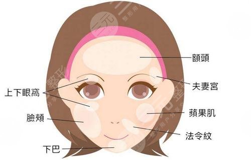 玻尿酸豐面頰需要多少?錢(qián)?