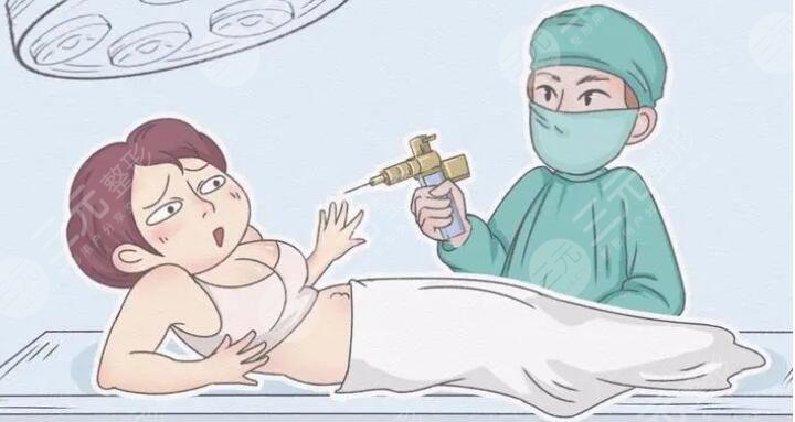 腹部抽脂手術(shù)的注意事項(xiàng)