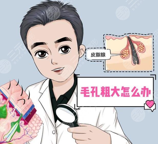 　　男性毛孔粗大怎么辦?這種方式其實(shí)是很不錯(cuò)的，而且能夠讓整個(gè)人的皮膚狀態(tài)看上去更加的美觀，能夠更好的改良毛孔粗大的問題，從而讓整個(gè)人的肌膚狀態(tài)看上去更加的精美和自然。其實(shí)很多的男性毛孔都是比較粗大的，想要更好的改良方式也是較多的，可以根據(jù)自己的皮膚狀態(tài)選擇更加適合的方式進(jìn)行緩解，也可以去專業(yè)的醫(yī)院進(jìn)行一定的咨詢，下面我們一起來了解了解男性毛孔粗大怎么辦?  　　一、男性毛孔粗大怎么辦?  　　男生毛孔粗大，可以在專業(yè)醫(yī)生的指導(dǎo)下，使用局部的外用藥物進(jìn)行改良，同時(shí)也可以采用光子嫩膚的方式進(jìn)行一定的調(diào)節(jié)。還可以使用果酸，煥膚等方式進(jìn)行一定的緩解，這幾種操作方式都并不是特別的繁瑣和復(fù)雜，能夠讓整個(gè)人的皮膚狀態(tài)看上去更加的美觀。  　　1、局部使用藥物。其實(shí)局部的使用藥物能夠讓整個(gè)人的皮膚看上去更加的年輕化和光滑，一般不會(huì)出現(xiàn)劇烈的刺痛感和疼痛感，反而能夠讓肌膚狀態(tài)看上去更加的年輕化和自然化，改良了肌膚衰老的感覺。當(dāng)男生毛孔過于粗大時(shí)，可以使用一些維a酸乳膏或者是水楊酸乳膏進(jìn)行一定的涂抹，能夠讓肌膚看上去更加的年輕化，加速角質(zhì)的排出，溶解角質(zhì)，因此能夠更好的改良毛孔粗大等方面的問題，從而讓整個(gè)人的皮膚狀態(tài)看上去更加的光滑，也能夠讓個(gè)人的氣質(zhì)得到一定的提升。  　　2、光子嫩膚。當(dāng)毛孔粗大時(shí)，可以在專業(yè)醫(yī)生的指導(dǎo)下，利用光子嫩膚產(chǎn)生的強(qiáng)脈沖光能量，因此能夠讓整個(gè)人的皮膚狀態(tài)看上去更加的年輕化，而且在處理的過程中整個(gè)人的膠原蛋白能夠得到一定的提升，纖維蛋白源也會(huì)增多，一般是不會(huì)出現(xiàn)不適癥狀的。做緩解的過程中，能達(dá)到皮膚深層組織，玩更好的抑制皮膚表面細(xì)菌繁殖，并且也能夠減少油脂分泌，因此通過做該緩解能夠縮小毛孔并且改良毛孔粗大的現(xiàn)象，讓整個(gè)人的皮膚看上去更加的光滑，也能夠讓肌膚看上去更加的年輕化，改良衰老的感覺，從而提升個(gè)人的氣質(zhì)。  　　3、果酸換膚。果酸換膚緩解，是利用高濃度的果酸對(duì)皮膚進(jìn)行剝離，通過做該緩解，不僅能夠讓皮膚狀態(tài)看上去更加的年輕化，同時(shí)還可以使老化的角質(zhì)層脫落，能夠促進(jìn)新的細(xì)胞再次生長(zhǎng)，因此采用這種方式能夠更好的美白自己的肌膚，同時(shí)也能夠讓個(gè)人的肌膚狀態(tài)看上去更加的年輕化，從而縮小毛孔。  　　二、男性收縮毛孔的注意事項(xiàng)  　　男生毛孔粗大需要做好面部的護(hù)理工作，不要在陽光下進(jìn)行暴曬，否則可能會(huì)出現(xiàn)劇烈的刺痛感和疼痛感，而且在出門的時(shí)候也要記得對(duì)肌膚進(jìn)行一定的防曬，可以適當(dāng)?shù)耐磕ǚ罆袼?，并且也可以打遮陽傘或者是穿防曬衣。想要讓自己毛孔粗大的現(xiàn)象得到更好的改良，而且對(duì)于臉部的清潔和護(hù)理是要更加的注重每天，都可以用溫水洗臉，能夠清除臉部的大部分雜質(zhì)和雜菌，同時(shí)也要注重臉部的補(bǔ)水。