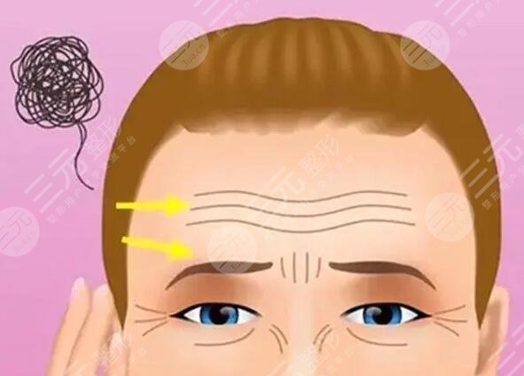 怎么樣去掉抬頭紋有效的小妙招！提醒您這幾種方式有效！網(wǎng)友們都愛(ài)！
