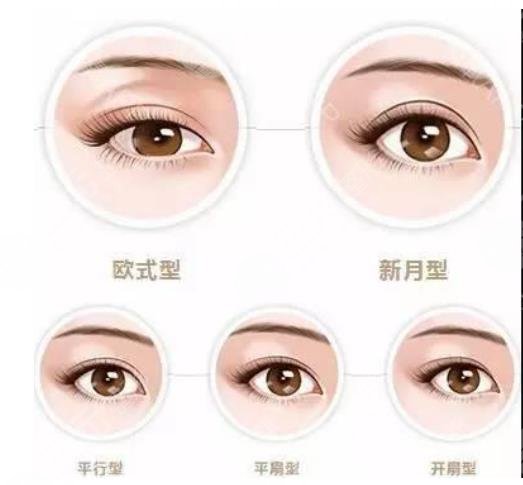 雙眼皮