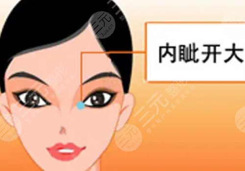 影響開內(nèi)眼角手術(shù)價格的因素有哪些?