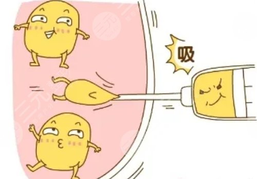 腹部吸脂肪有什么后遺癥?
