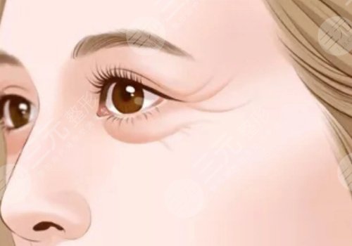 去魚尾紋的眼霜排名