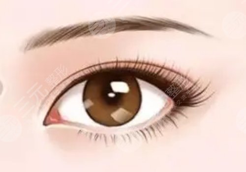 割雙眼皮有什么危害或者后遺癥?