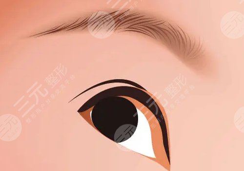 割雙眼皮有什么危害或者后遺癥?