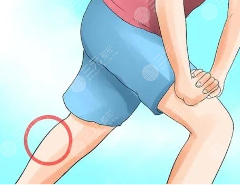 小腿吸脂手術(shù)價格多少錢2023？手術(shù)注意事項說明，擁有漫畫版修長腿！