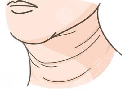 如何消除頸紋?