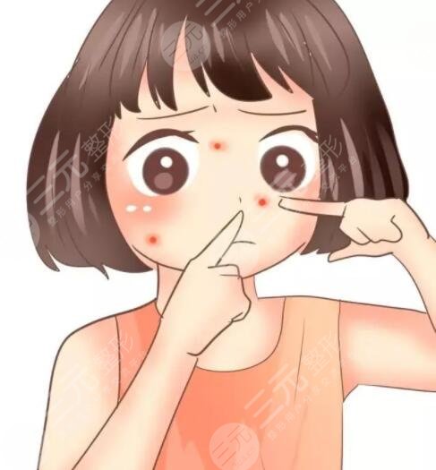 激光手術(shù)修復(fù)痘印痘坑能夠維持多久?