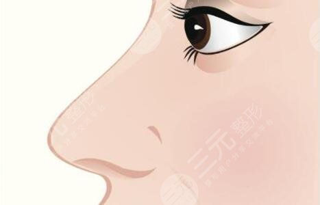 鼻子整形可以維持一輩子嗎？10年、20年后怎么辦？鼻科醫(yī)生告訴你實(shí)情！