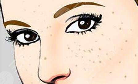 蜂蜜祛斑的小竅門(mén)是什么？具體制作操作大全記錄，長(zhǎng)期堅(jiān)持有！