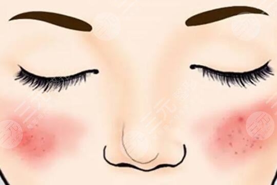 點(diǎn)陣激光的作用和功效逐一瀏覽，效果可以維持幾年？術(shù)后注意事項(xiàng)！