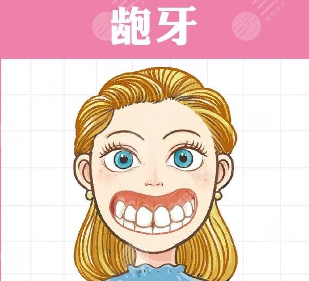 深覆合矯正要多久？