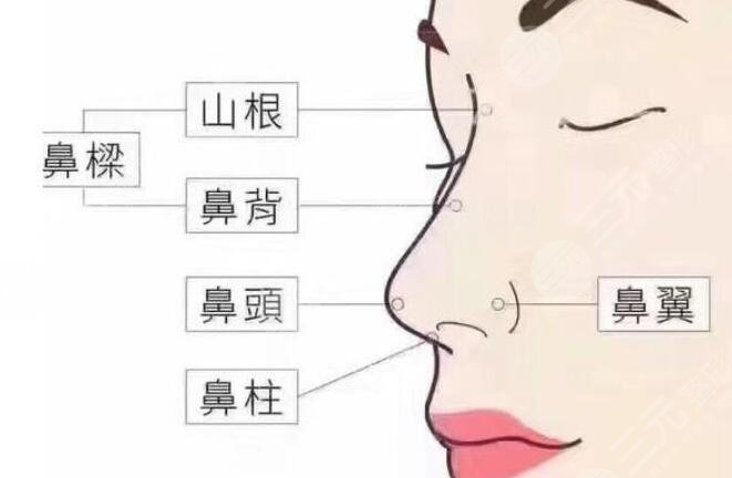 膨體隆鼻有什么優(yōu)缺點?